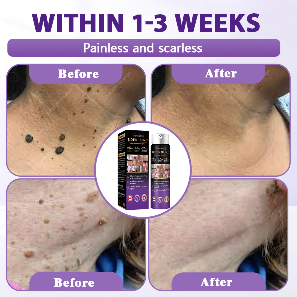 Made and Shipped from Canada✨Evolvion® Biotin 10-in-1 Skin Restoration Spray 🍇