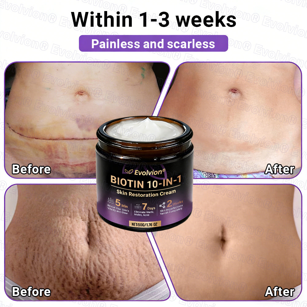 Made and Shipped from Canada ✨Evolvion® Biotin 10-in-1 Skin Restoration Cream 🎉🎉🎉