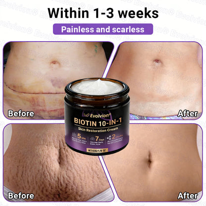 Made and Shipped from Canada ✨Evolvion® Biotin 10-in-1 Skin Restoration Cream 🎉🎉🎉