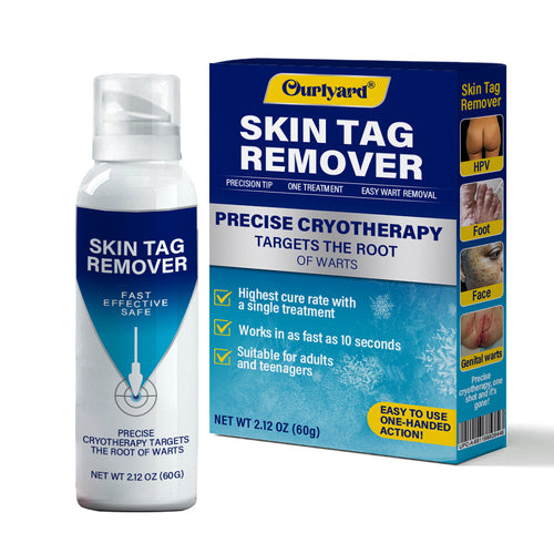 ✅ Official Store | Ourlyard® TagRecede Cryo Treatment Spray  |  Removes warts and skin tags, suitable for all skin types.🍀