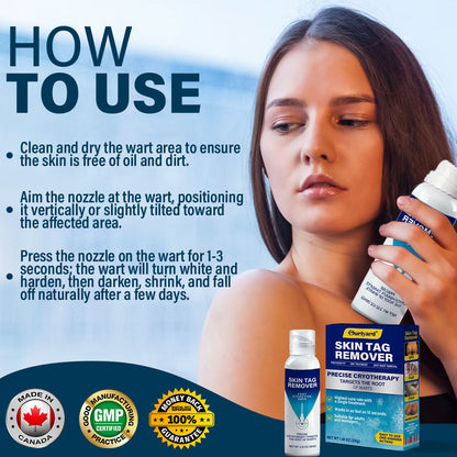 ✅ Official Store | Ourlyard® TagRecede Cryo Treatment Spray  |  Removes warts and skin tags, suitable for all skin types.🍀