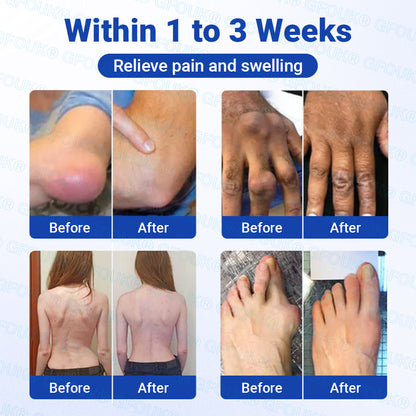 𝐎𝐟𝐟𝐢𝐜𝐢𝐚𝐥 𝐒𝐭𝐨𝐫𝐞 🇨🇦 | GFOUK® BPC-157 × NSAID 10-in-1 Penetrating Greaseless Arthritis Gel