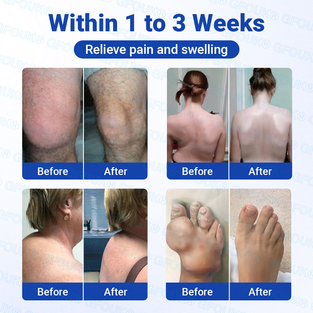 𝐎𝐟𝐟𝐢𝐜𝐢𝐚𝐥 𝐒𝐭𝐨𝐫𝐞 🇨🇦 | GFOUK® BPC-157 × NSAID 10-in-1 Penetrating Greaseless Arthritis Gel