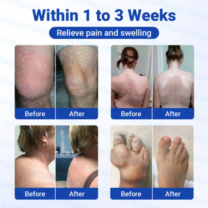 𝐎𝐟𝐟𝐢𝐜𝐢𝐚𝐥 𝐒𝐭𝐨𝐫𝐞 🇨🇦 | GFOUK® BPC-157 × NSAID 10-in-1 Penetrating Greaseless Arthritis Gel
