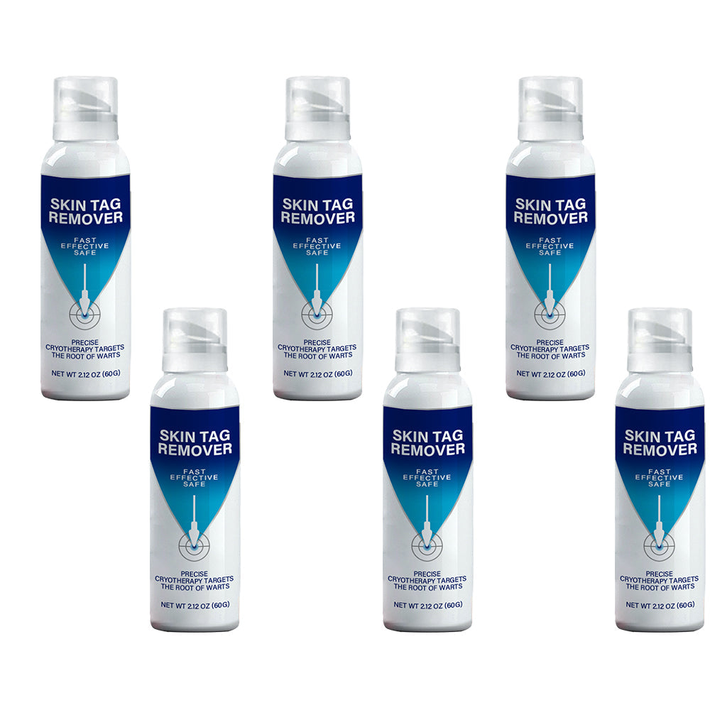 ✅ Official Store | Ourlyard® TagRecede Cryo Treatment Spray  |  Removes warts and skin tags, suitable for all skin types.🍀