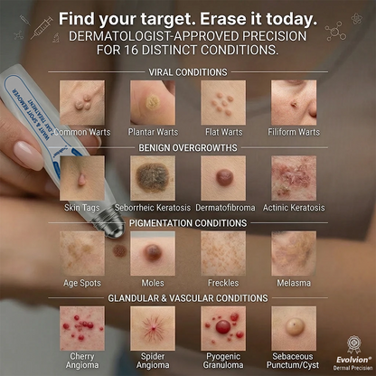 Made and Shipped from CA ✨Evolvion® 𝟕-𝐃𝒂𝘆 𝐒𝗸𝐢𝐧 𝐓𝒂𝗴 & 𝐒𝐩𝙤𝐭 𝐄𝐫𝒂𝐬𝙚𝐫 Painless & Scar-Free Advanced Imperfection Remova𝗜 Ro𝗜𝗜erba𝗜𝗜 Pen