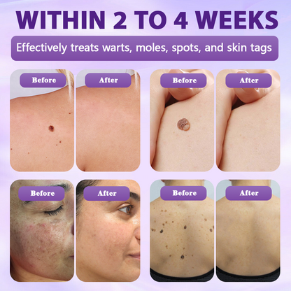 Made and Shipped from Canada✨Evolvion® Biotin 10-in-1 Skin Restoration Spray 🍇