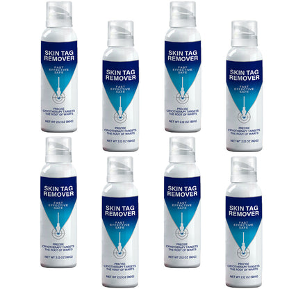 ✅ Official Store | Ourlyard® TagRecede Cryo Treatment Spray  |  Removes warts and skin tags, suitable for all skin types.🍀