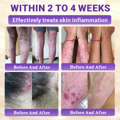 Made and Shipped from Canada ✨Evolvion® Biotin 10-in-1 Skin Restoration Cream 🎉🎉🎉