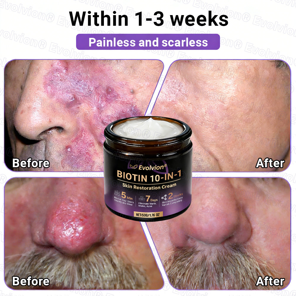 Made and Shipped from Canada ✨Evolvion® Biotin 10-in-1 Skin Restoration Cream 🎉🎉🎉