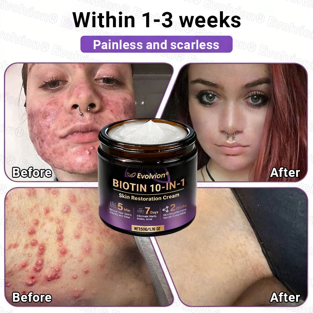 Made and Shipped from Canada ✨Evolvion® Biotin 10-in-1 Skin Restoration Cream 🎉🎉🎉